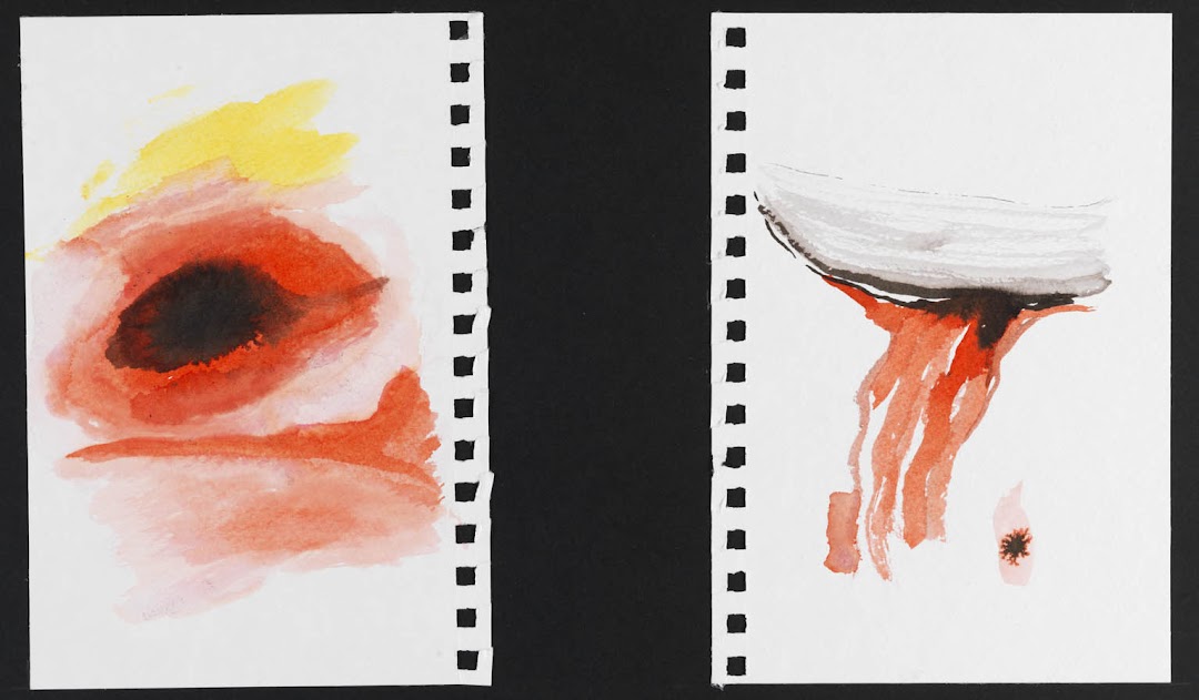 Convulsión I e II-2012